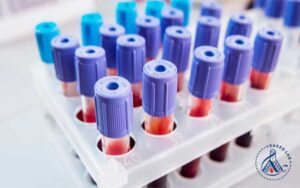 تشخیص آزمایشگاهی بیماری‌های مفصلی