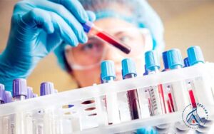 تشخیص آزمایشگاهی بیماری‌های مفصلی