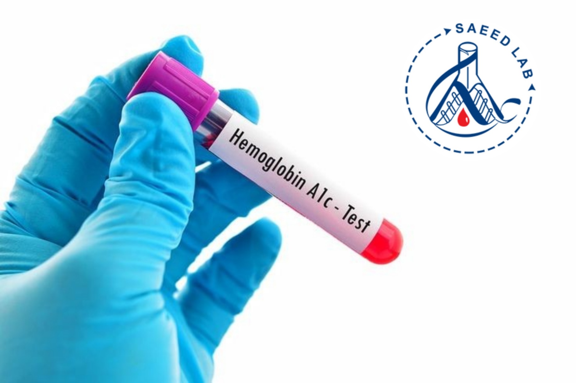 آزمایش hba1c
