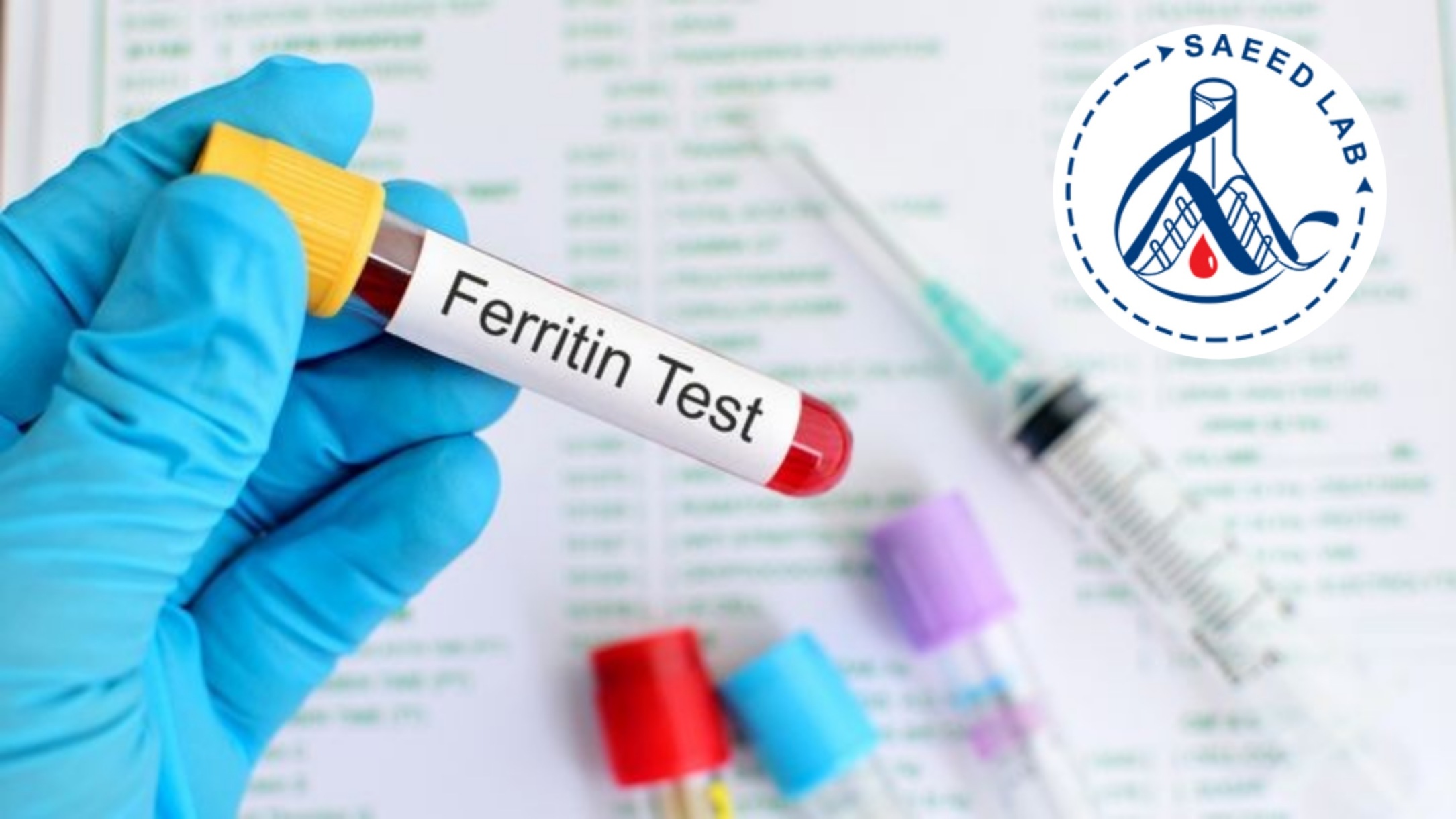 ferrtin test